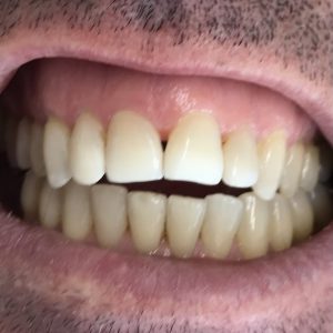 Dr. Stan Heifetz: Expertise in Invisible Retainers and Smile Transformation